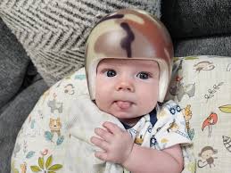 Thank you for the prayers and support during Walker's surgery