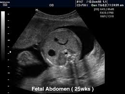 We did not find results for: Ultrasound Images Fetus Abdomen 25 Weeks 298 Accuvix Xq