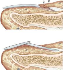 Image result for Beau lines feet