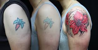 That's a lot of skin you're having scraped off, so you may only want to try this method for how dermabrasion tattoo removal works. Analytical Chemistry And The Hidden Risks Of Laser Tattoo Removal Prescouter Custom Intelligence From A Global Network Of Experts