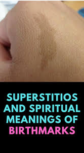 Birthdays Was The Worst Days Meaning Birthmarks Spiritual Meanings Superstitions Insight State Spiritual Meaning Birthmark Spirituality