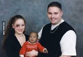 White Mommy White Daddy Black Baby Black Eye 9gag
