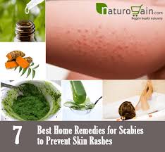 7 Best Home Remedies For Scabies To Prevent Skin Rashes Home Remedies For Scabies Home Remedies Remedies
