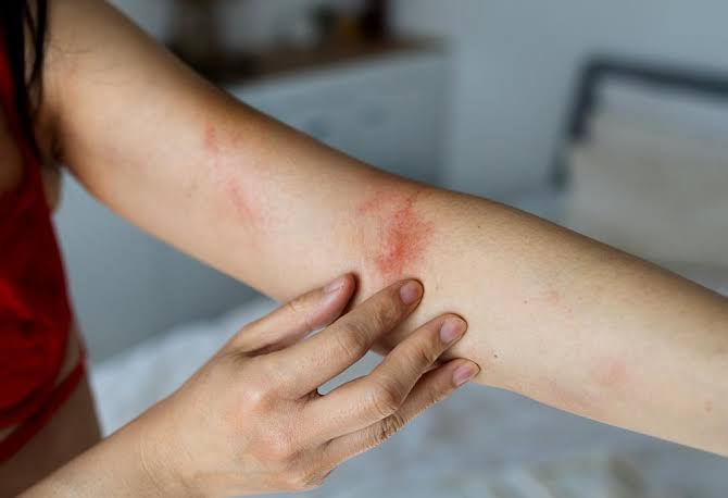Kem hăm cho người lớn: Top 5 loại bán rất chạy mỗi mùa nắng nóng