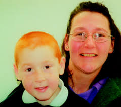 Extreme variability of expression of a Sonic Hedgehog mutation: attention  difficulties and holoprosencephaly