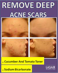 Pin On Anti Aging Solutions
