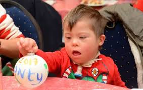 The incredible four-year-old who has major surgery every six weeks