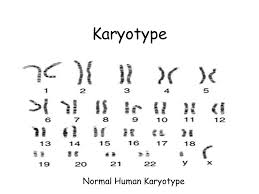 Karyotype A Chart Of Chromosome Pairs Arranged By Length And