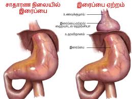 ஆண கள த த க க ம இர ப ப ஏற றம இத கண ட க ள ள மல வ ட ட ல சந த க க ம அப யம என ன த ர ய ம Hiatal Hernia In Men Know The Symptoms And Preventive Measures