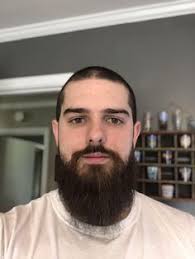 The new incoming hair naturally pushes the old hair out of the skin and eventually causes it to fall off, completing the human beard growth cycle. Teenage Beard Growth Stages My Beard Gang