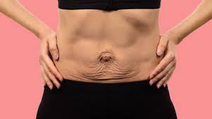 Saggy Skin After Pregnancy 7 Ways To Eliminate Loose Skin