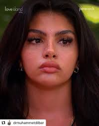 Devastating 💔 RIP to this young man! It is being said that he had a phenol  peel done at the clinic of Natalia Becker in San Pablo, Brazil! I would  love to