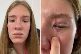 Mermaid Performer Recalls Giant Fish Biting Her Head in Aquarium Exhibit  (Exclusive)