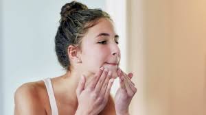 Tips when looking for a hair gel for curly hair. Acne Vulgaris Symptoms Pictures Treatments And More