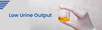 Image result for Urine Output