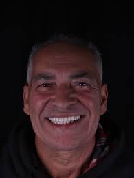 Dr Gabriel Stipe l Estética Dental (@drgabrielstipe) • Instagram photos and  videos