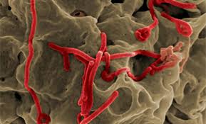 Scientists think people are initially infected with ebola virus through contact with an infected animal, such as a fruit bat or nonhuman primate. Factsheet About Ebola And Marburg Virus Diseases