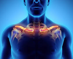 Thoracic Outlet Syndrome Presenting As An Acute Stroke Mimic