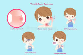 Even more advanced forms of thyroid cancer can often be treated effectively. Man With Thyroid Cancer Stock Vector Illustration Of Frustrated 115267012