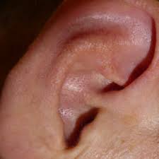 Tinnitus Ursachen Behandlung Homoopathie Proplanta De