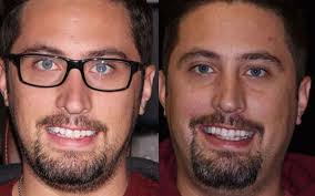 Family Dental Care in Flagstaff, Cottonwood, and Sedona