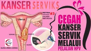 Ujian pap smear dilakukan dengan menggunakan spekulum atau berus serviks yang akan dimasukkan ke dalam faraj. Ujian Pap Smear Untuk Klinik Anda Cheras Balakong 24jam Facebook