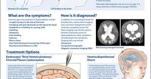 Neurosurgery Posters On Behance In 2020 Book Study Poster Health Science
