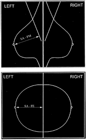 Image result for Mammogram Interpretation