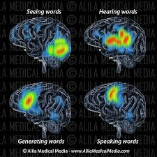 Pet Scan Of Brain During Speech Pet Scan Medical Illustration Medical Specialties
