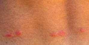 Auch einfach in das gefrierfach gesteckt werden, auch durch kälte lassen sich flöhe bekämpfen. Flohe Im Bett Entdeckt Flohe Bekampfen Aber Richtig