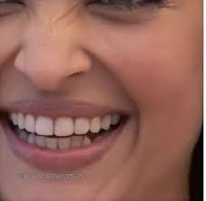 Pin By Rockstar Raghav On Actresses Oral Health Oral Teeth