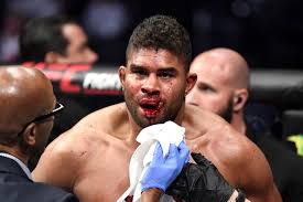 50% 272 голова 35% 191 корпус 15% 82 ноги. Alistair Overeem S Lip Explodes In Shocking Ufc Knockout