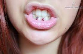 Frowny Piercing Google Search Guby Telo