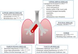 Pharmaceuticals Free Full Text Respiratory Manifestations In Systemic Lupus Erythematosus Html