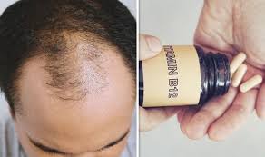 Excess may anytime reverse its benefits and it is important that a safe vitamin c intake regimen is maintained to keep hair from drying, thinning and falling off. Hair Loss Treatment Vitamin B12 Supplementation Could Stop Hair Thinning Express Co Uk