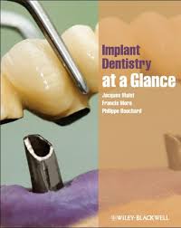 Implant Dentistry At A Glance Pdf Malet Jacques Free Medical Books Repost By The New Era Group We Grow Our Bus Implant Dentistry Dentistry Teeth Implants