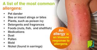 Dogs also can suffer from food intolerance, which is different from a food allergy. Common Allergies Causes Triggers Symptoms And Treatment Information Parlour