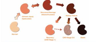 This is a medical term for kidney disease that requires dialysis or kidney transplant for a patient to stay alive. Kidney Disease Elwood Vet