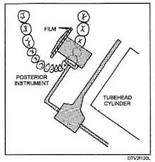 vertical angulation