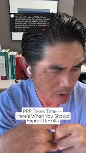 A great question: When does PRP actually start working? Unlike cortisone,  PRP doesn’t give instant relief. It triggers a cellular healing response,  which takes time. Most people don’t feel change for ...