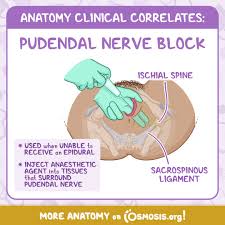 Image result for Pudendal Block