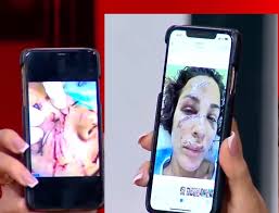 We did not find results for: Ù†Ø§Ø¯ÙŠÙ† Ù†Ø³ÙŠØ¨ Ù†Ø¬ÙŠÙ… ØªØ¸Ù‡Ø± Ø­Ø¬Ù… ØªØ´ÙˆÙ‡ ÙˆØ¬Ù‡Ù‡Ø§ Ø¨Ø¹Ø¯ Ø§Ù„Ø§Ù†ÙØ¬Ø§Ø± Ø¨ØµÙˆØ± ØªØªØ´Ø± Ù„Ø£ÙˆÙ„ Ù…Ø±Ø© Ù…Ø¬Ù„Ø© Ù‡ÙŠ