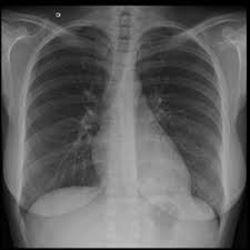 Emprego Dos Exames De Imagem No Diagnostico Das Doencas Toracicas Artigos Fleury Medicina E Saude