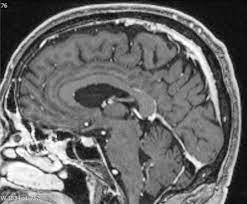 Magnetresonanztomographie Mrt Des Kopfes Ct Mrt Institut Berlin
