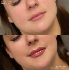 emilyrockwell_np said it perfectly