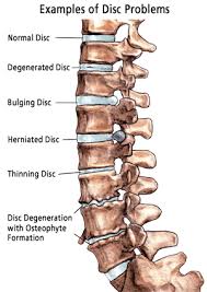 Pin On Health Conditions We Treat