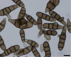 Immagine di Alternaria brassicicola maculatura fogliare brassiche