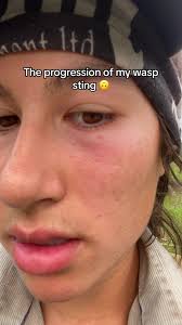 Shes looking a lot better now #treeplanting #planting