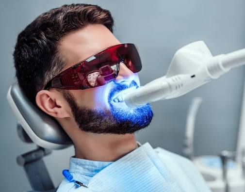 Laser Teeth Whitening Vs. Bleaching (2023) – NatruSmile