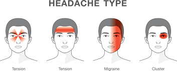We did not find results for: Bukan Semua Sakit Kepala Migraine Tapi Ada Kaitan Dengan Keturunan Doktor Jelaskan Punca Berlaku Remaja